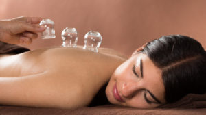 Woman Getting Cupping Treatment