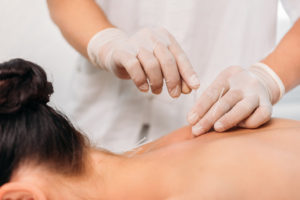 dry-needle-therapy-wellnest